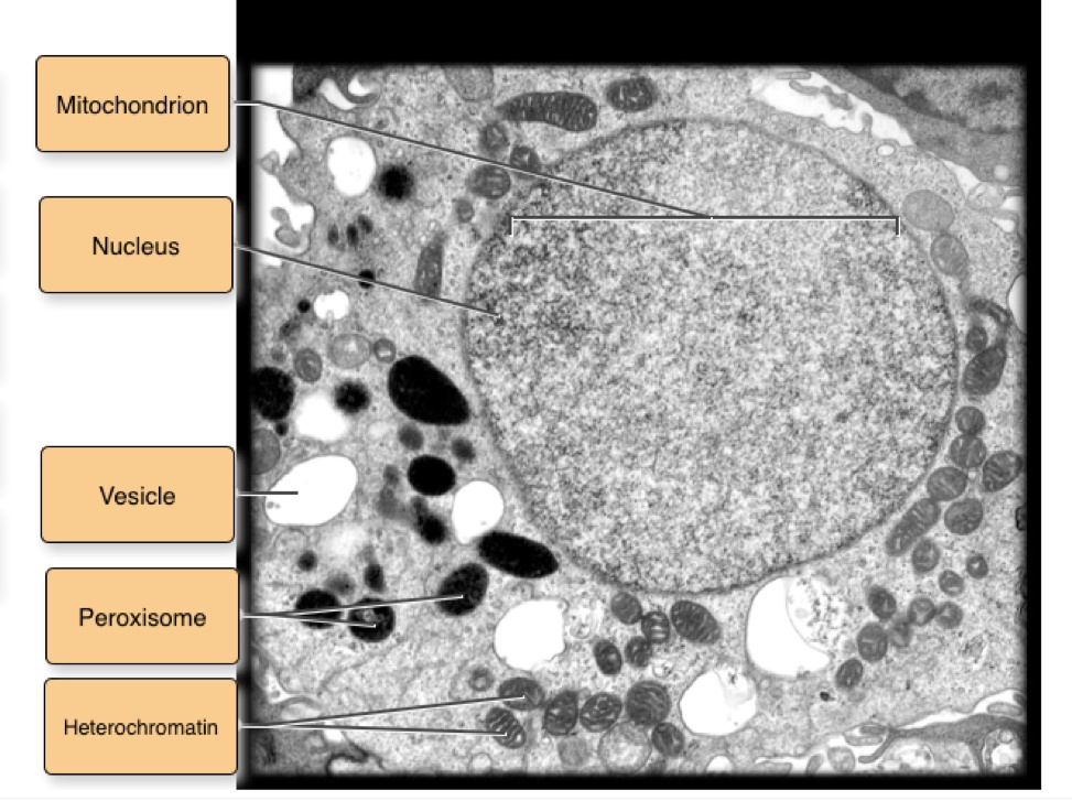 Transmission electron micrograph