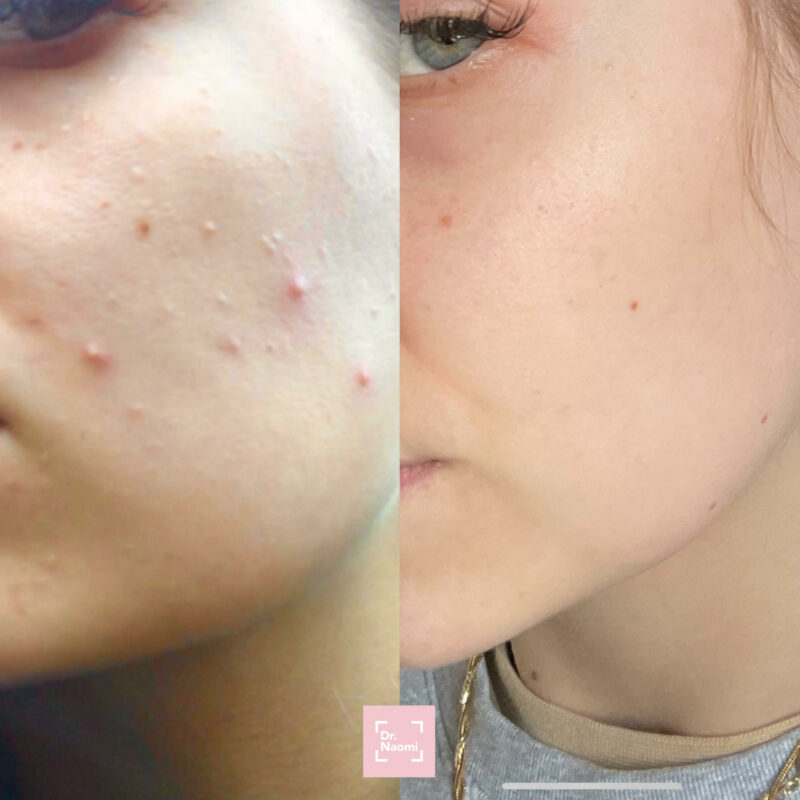 In your face skincare