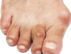 bunion walking shoes for women Comfort with Style