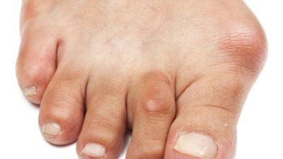 bunion walking shoes for women Comfort with Style